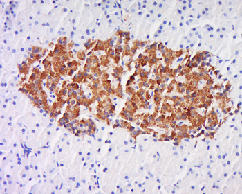 C21orf2 Rabbit Polyclonal Antibody