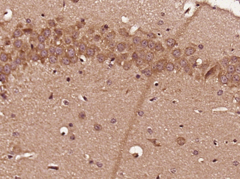 CD168 Rabbit Polyclonal Antibody