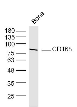 CD168 Rabbit Polyclonal Antibody