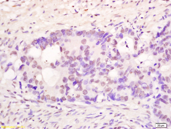 PMS1 Rabbit Polyclonal Antibody