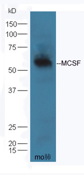 CSF1 Rabbit Polyclonal Antibody