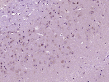 NPTX2 Rabbit Polyclonal Antibody