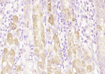 C21orf70 Rabbit Polyclonal Antibody