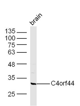 C4orf44 Rabbit Polyclonal Antibody