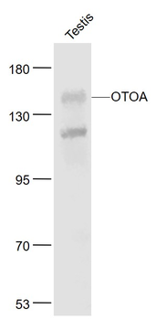 OTOA Rabbit Polyclonal Antibody