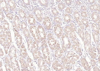 Latency-associated peptide Rabbit Polyclonal Antibody
