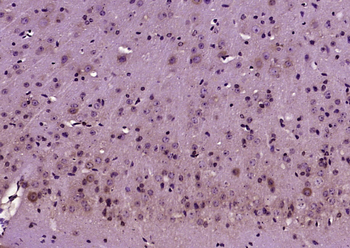 KIF5A/NKHC1 Rabbit Polyclonal Antibody