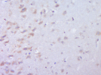 C22orf25 Rabbit Polyclonal Antibody