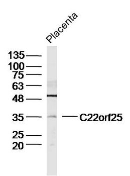 C22orf25 Rabbit Polyclonal Antibody