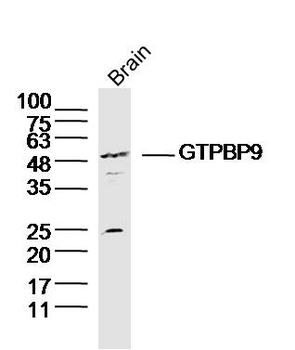 GTPBP9 Rabbit Polyclonal Antibody