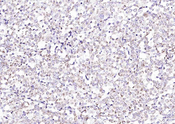 KCNMA1/BK channel Rabbit Polyclonal Antibody