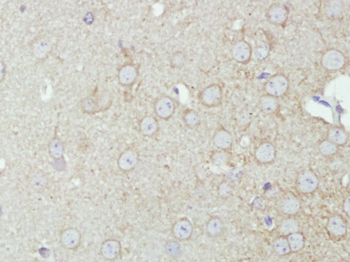 KCNMA1/BK channel Rabbit Polyclonal Antibody
