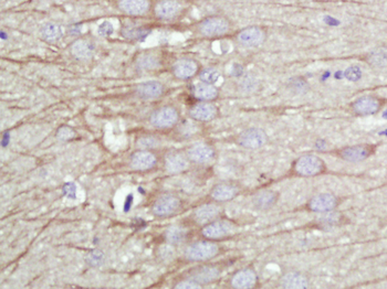 KCNMA1/BK channel Rabbit Polyclonal Antibody