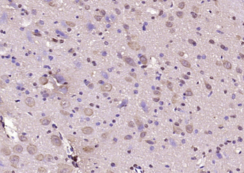 STAU2 Rabbit Polyclonal Antibody