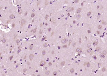 CNTNAP3 Rabbit Polyclonal Antibody