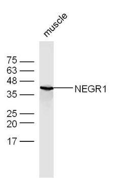 NEGR1 Rabbit Polyclonal Antibody