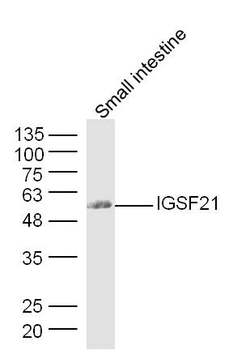 FAM83F Rabbit Polyclonal Antibody