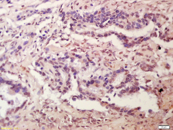 Plakophilin 2 Rabbit Polyclonal Antibody