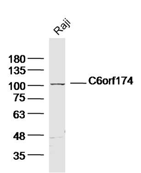 C6orf174 Rabbit Polyclonal Antibody