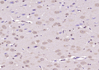 FSIP1 Rabbit Polyclonal Antibody