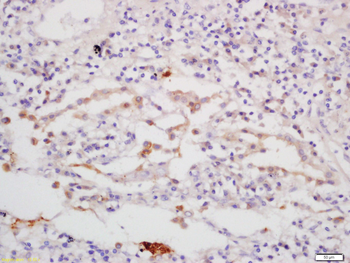 CGAS Rabbit Polyclonal Antibody