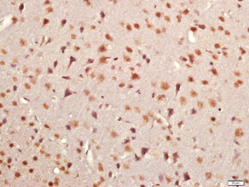 KRCC1 Rabbit Polyclonal Antibody