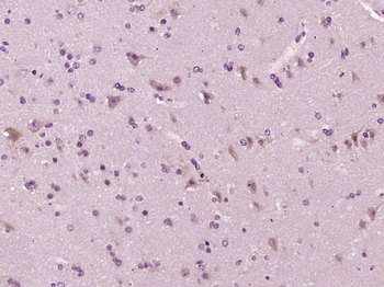 PCDH7 Rabbit Polyclonal Antibody