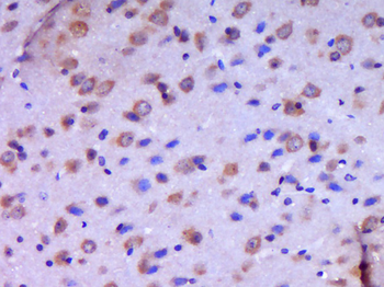 JAMC Rabbit Polyclonal Antibody