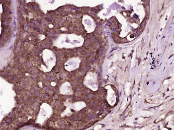 Transglutaminase 2 Rabbit Polyclonal Antibody