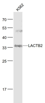 LACTB2 Rabbit Polyclonal Antibody