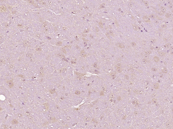 Junctophilin 4 Rabbit Polyclonal Antibody