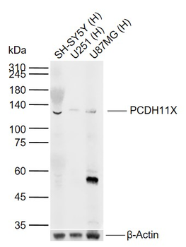 PCDH11X Rabbit Polyclonal Antibody