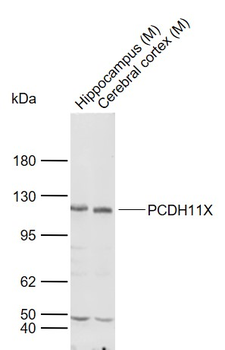 PCDH11X Rabbit Polyclonal Antibody