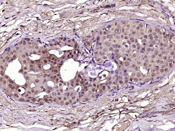 ALPK3 Rabbit Polyclonal Antibody