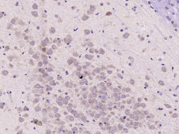 Phospho-BRAF (Ser365) Rabbit Polyclonal Antibody