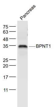 BPNT1 Rabbit Polyclonal Antibody