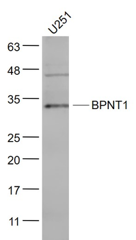 BPNT1 Rabbit Polyclonal Antibody