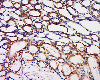 BPNT1 Rabbit Polyclonal Antibody