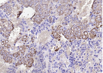 CHRNA7 Rabbit Polyclonal Antibody