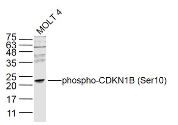 Phospho-CDKN1B (Ser10) Rabbit Polyclonal Antibody