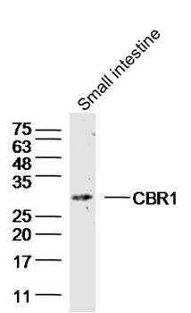 CBR1 Rabbit Polyclonal Antibody