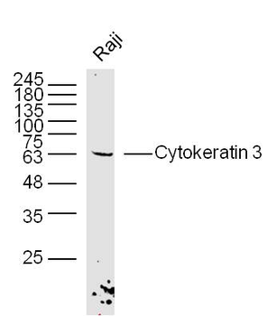 Cytokeratin 3 Rabbit Polyclonal Antibody