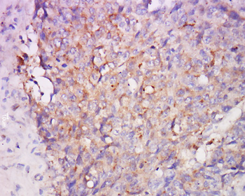 DLC1 Rabbit Polyclonal Antibody