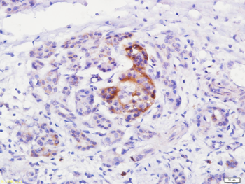 ELMO2 Rabbit Polyclonal Antibody