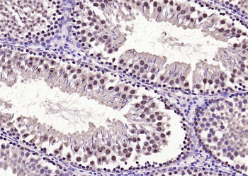 Phospho-FoxO1 (Ser319) Rabbit Polyclonal Antibody