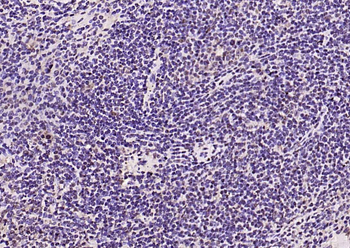 Phospho-FoxO1 (Ser319) Rabbit Polyclonal Antibody