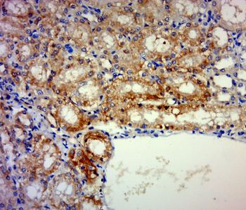 GRINA Rabbit Polyclonal Antibody