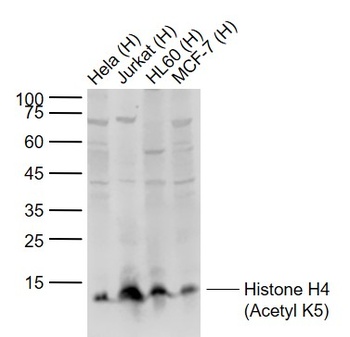 Histone H4 (Acetyl K5) antibody