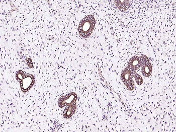 IGF 1 Rabbit Polyclonal Antibody