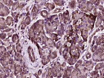 SEMA3G Rabbit Polyclonal Antibody